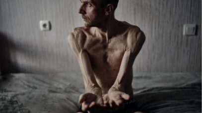 “You torture Russians, too” UN says, as skeletal Ukrainian prisoners